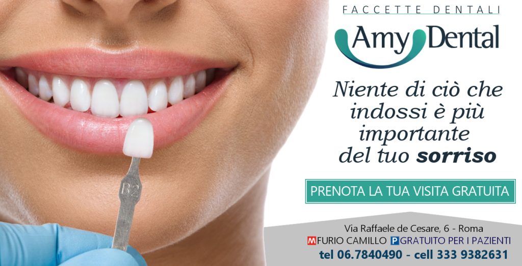 Faccette dentali: cosa sono e come si applicano