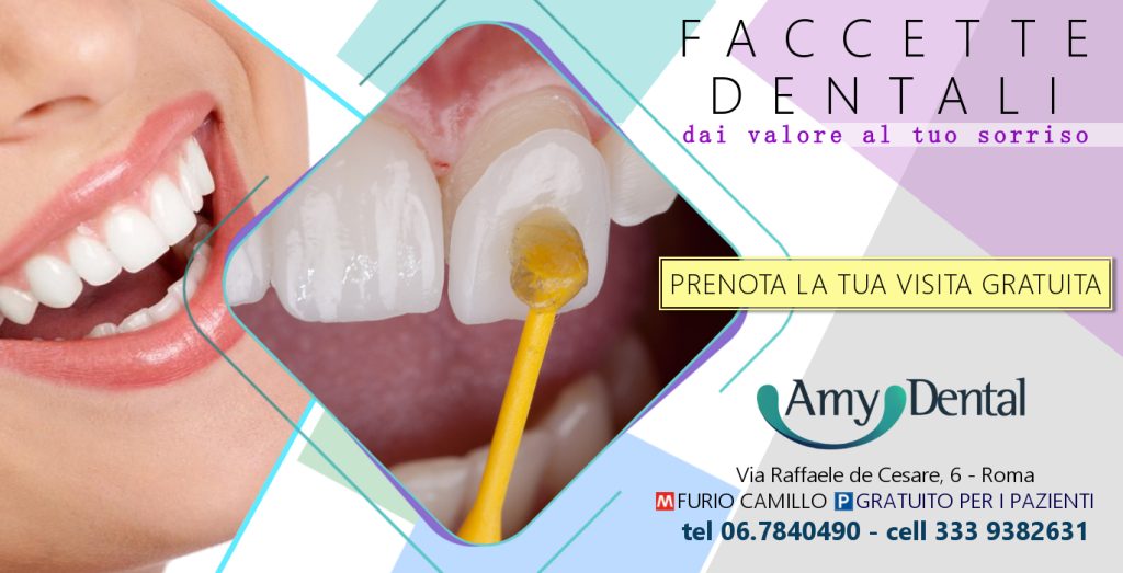 Faccette dentali: cosa sono e quanto costano