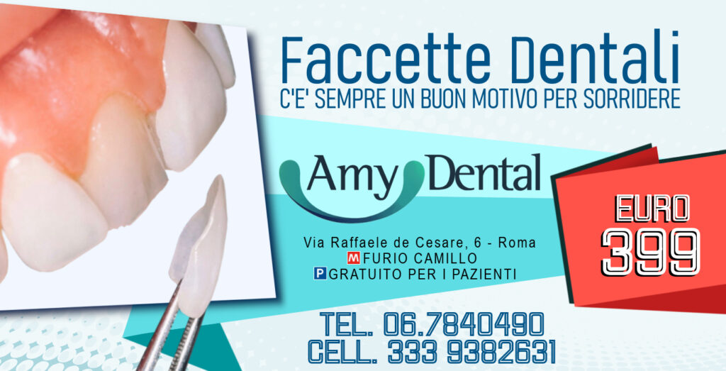 Faccette estetiche a Roma