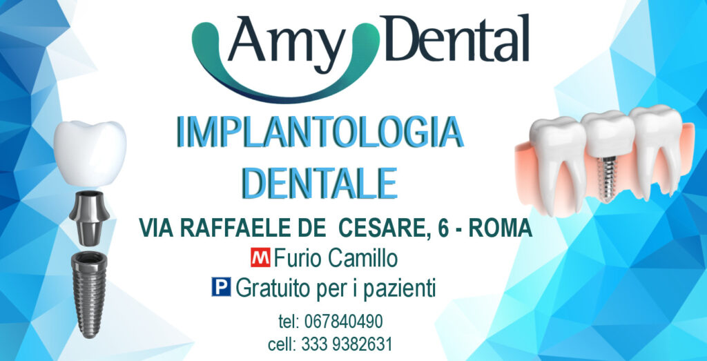 Quanto costa un impianto dentale a Roma