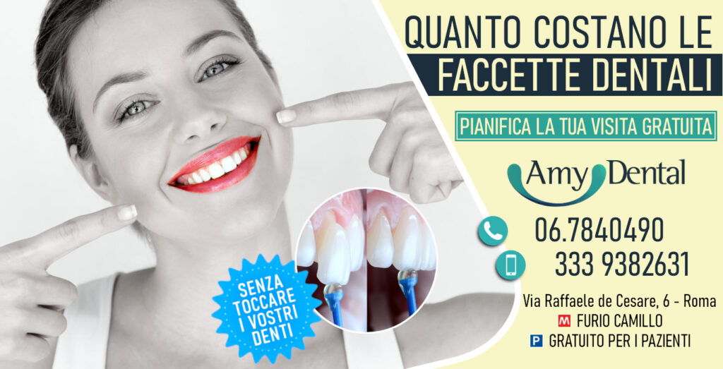 Quanto costano le faccette dentali